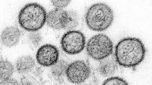 hantavirus